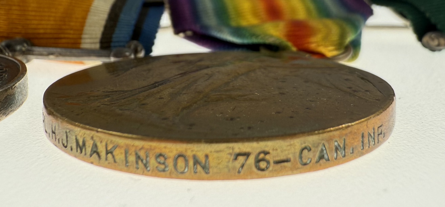 WWI - Double Long Service Medal Group to 76th Battalion / 2/10 Dragoons / Royal Hamilton Light Infantry - Makinson